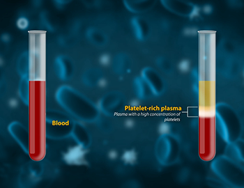 Biologics