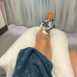 Anthony Yi, MD, Orthopedic Surgeon Specialist in Foot & Ankle Surgery