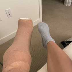 Anthony Yi, MD, Orthopedic Surgeon Specialist in Foot & Ankle Surgery