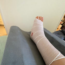 Anthony Yi, MD, Orthopedic Surgeon Specialist in Foot & Ankle Surgery