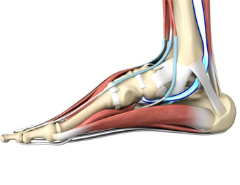 Posterior Tibial Tendon Dysfunction
